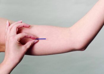 Contraceptivo de longa duração, Implanon entra na cobertura dos planos de saúde.