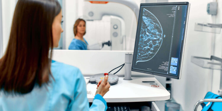 SUS passará a oferecer mamografia para mulheres de 40 a 49 anos sem necessidade de sintomas.